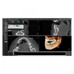 3D modul - OnDemand3D szoftver