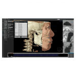 3D Ceph modul - OnDemand3D szoftver