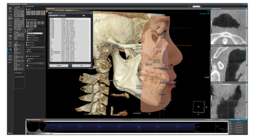 halmadent-OnDemand3D_modul_3D-Ceph 3DCeph modul - OnDemand3D szoftver