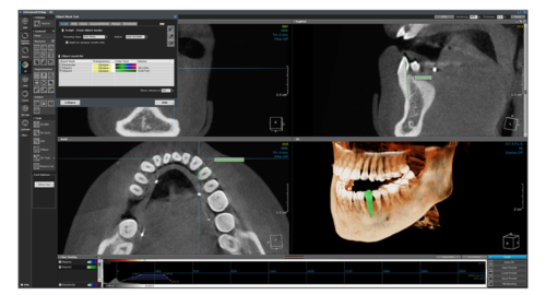 halmadent-OnDemand3D_modul_3D 3D modul - OnDemand3D szoftver