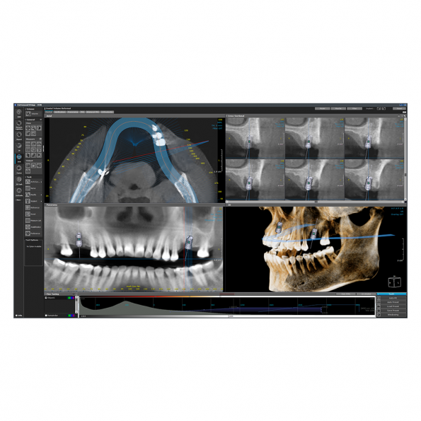 DVR modul - OnDemand3D szoftver