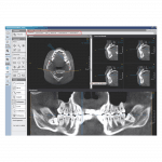 Dental modul - OnDemand3D szoftver
