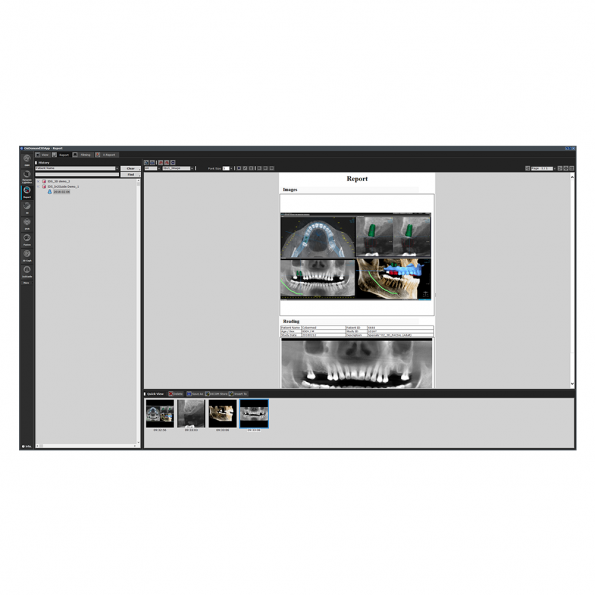 Report modul - OnDemand3D szoftver