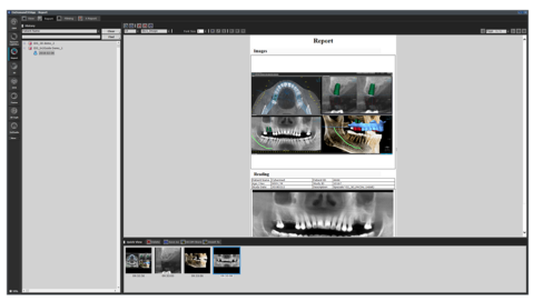 halmadent-OnDemand3D_modul_Report Report modul - OnDemand3D szoftver