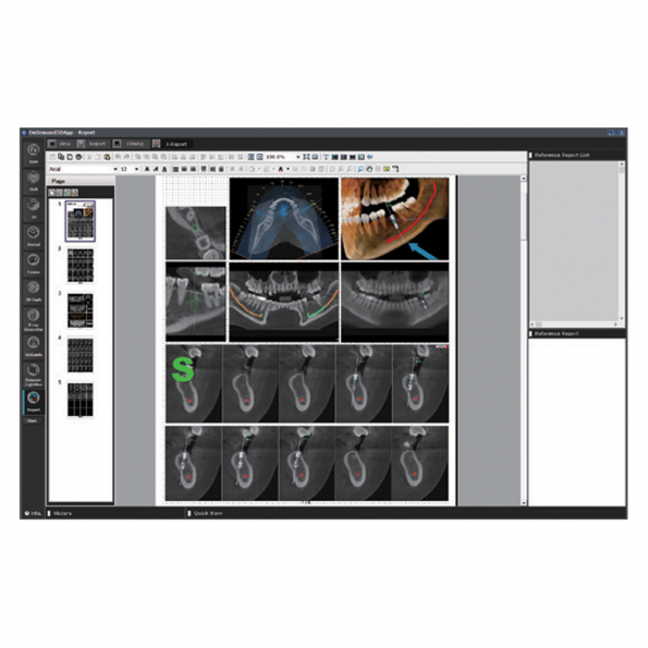 X-Report modul - OnDemand3D szoftver